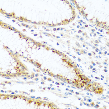 Immunohistochemistry - FAM3B Polyclonal Antibody 