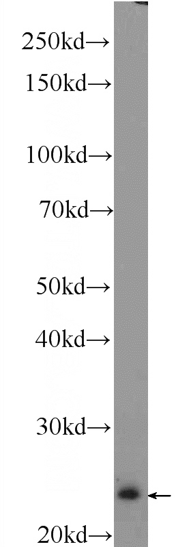 mouse brain tissue were subjected to SDS PAGE followed by western blot with Catalog No:114718(PEBP1 Antibody) at dilution of 1:600