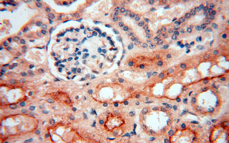 Immunohistochemical of paraffin-embedded human kidney using Catalog No:107931(AKAP14 antibody) at dilution of 1:50 (under 40x lens)