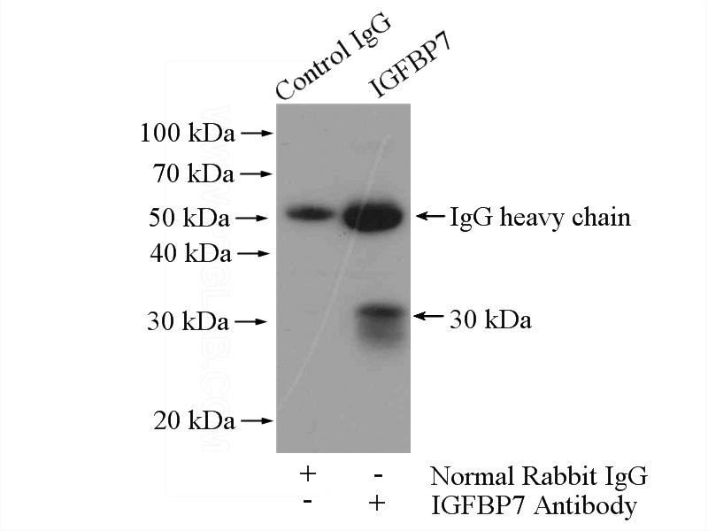 IP Result of anti-IGFBP7 (IP:Catalog No:111689, 4ug; Detection:Catalog No:111689 1:300) with mouse appendix tissue lysate 6000ug.