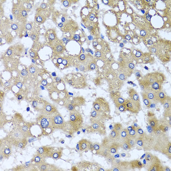 Immunohistochemistry - TTLL12 Polyclonal Antibody 
