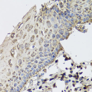 Immunohistochemistry - GBF1 Polyclonal Antibody 