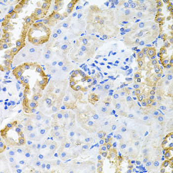 Immunohistochemistry - STRN3 Polyclonal Antibody 