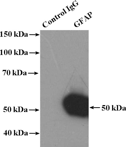 IP Result of anti-GFAP (IP:Catalog No:110944, 4ug; Detection:Catalog No:110944 1:1000) with mouse brain tissue lysate 4000ug.