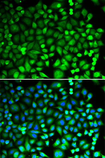 Immunofluorescence - PSMB2 Polyclonal Antibody 