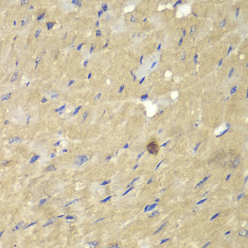 Immunohistochemistry - AKR7A2 Polyclonal Antibody 