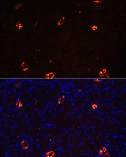 Immunofluorescence - AQP2 Polyclonal Antibody 