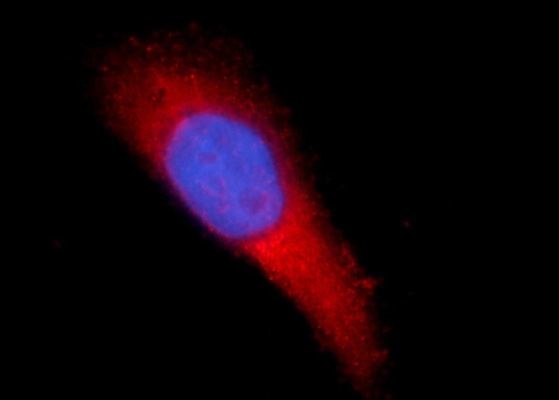Immunofluorescent analysis of HeLa cells using Catalog No:116187(TMEM38B Antibody) at dilution of 1:25 and Alexa Fluor 594-congugated AffiniPure Goat Anti-Rabbit IgG(H+L)