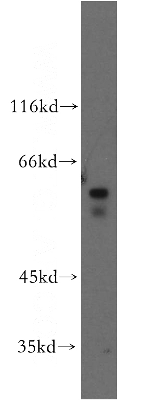SH-SY5Y cells were subjected to SDS PAGE followed by western blot with Catalog No:112699(MMP19 antibody) at dilution of 1:300