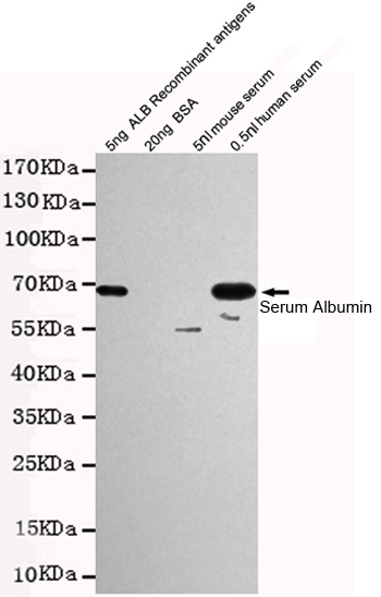 Western blot detection of Human Serum Albumin in 0.5nl human serum and 5ng ALB Recombinant antigens cell lysates using Human Serum Albumin mouse mAb (1:1000 diluted).Predicted band size:67KDa.Observed band size:67KDa.