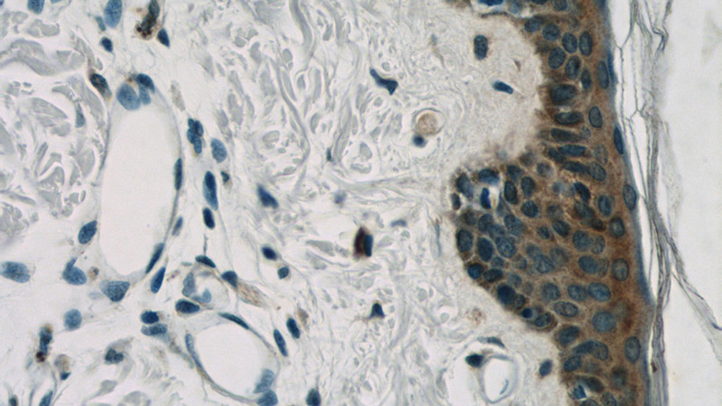 Immunohistochemistry of paraffin-embedded human skin slide using Catalog No:117109(BCR Antibody) at dilution of 1:50