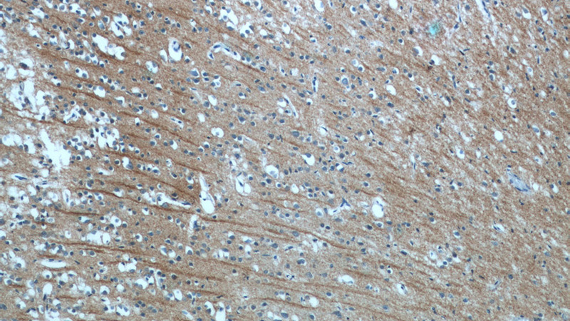 Immunohistochemistry of paraffin-embedded human brain tissue slide using Catalog No:113207(NPB Antibody) at dilution of 1:50 (under 10x lens)