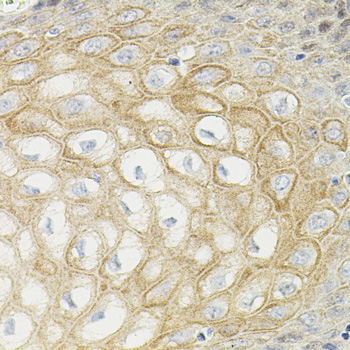 Immunohistochemistry - ATF6 Polyclonal Antibody 