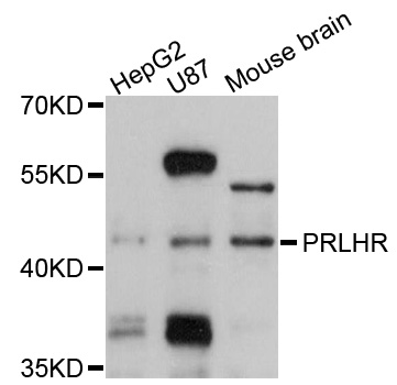Western blot - PRLHR Polyclonal Antibody 