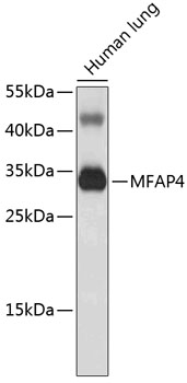 Western blot - MFAP4 Polyclonal Antibody 