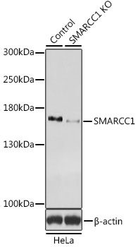 Western blot - SMARCC1 Polyclonal Antibody 