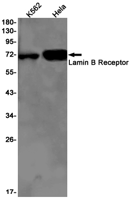 Western blot detection of Lamin B Receptor in K562,Hela cell lysates using Lamin B Receptor Rabbit pAb(1:1000 diluted).Predicted band size:71kDa.Observed band size:71kDa.
