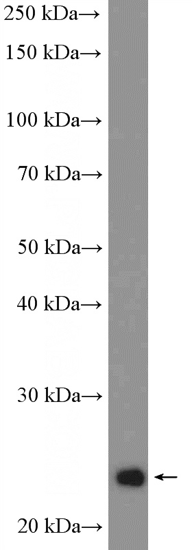 Y79 cells were subjected to SDS PAGE followed by western blot with Catalog No:114530(RALB Antibody) at dilution of 1:600