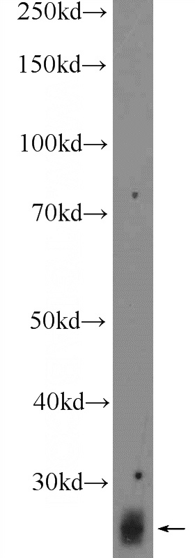 mouse testis tissue were subjected to SDS PAGE followed by western blot with Catalog No:114741(RNF141 Antibody) at dilution of 1:300