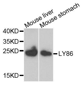 Western blot - LY86 Polyclonal Antibody 
