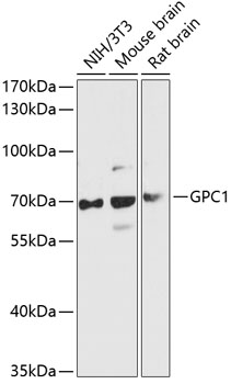 Western blot - GPC1 Polyclonal Antibody 