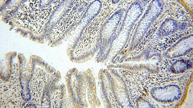Immunohistochemical of paraffin-embedded human colon using Catalog No:112081(KLF4 antibody) at dilution of 1:50 (under 10x lens)