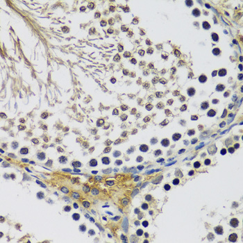 Immunohistochemistry - C10orf62 Polyclonal Antibody 