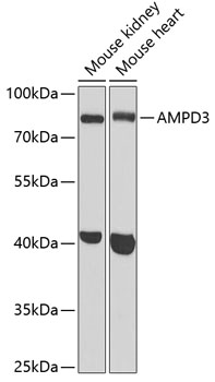 Western blot - AMPD3 Polyclonal Antibody 
