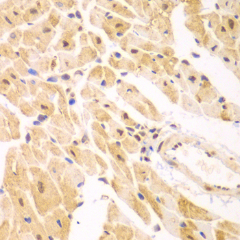 Immunohistochemistry - PSMD2 Polyclonal Antibody 