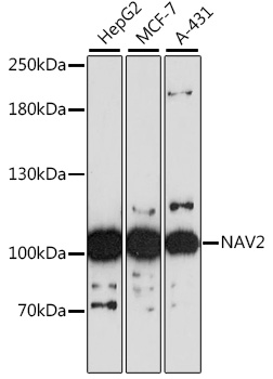 Western blot - NAV2 Polyclonal Antibody 