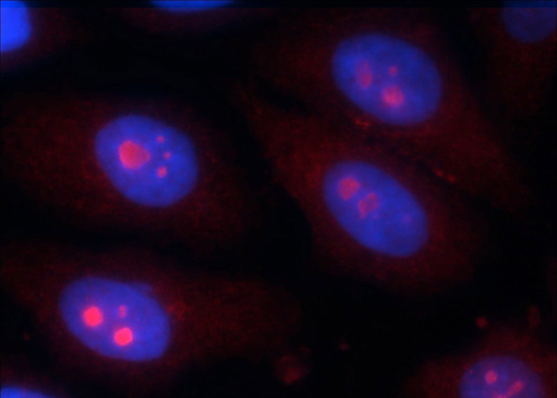Immunofluorescent analysis of HepG2 cells using Catalog No:111985(KIAA0774 Antibody) at dilution of 1:50 and Rhodamine-Goat anti-Rabbit IgG