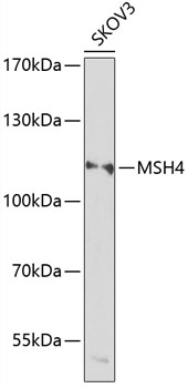 Western blot - MSH4 Polyclonal Antibody 