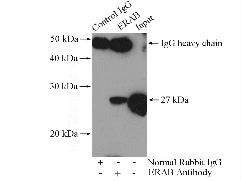 IP Result of anti-HSD17B10 (IP:Catalog No:110398, 4ug; Detection:Catalog No:110398 1:500) with HeLa cells lysate 1200ug.