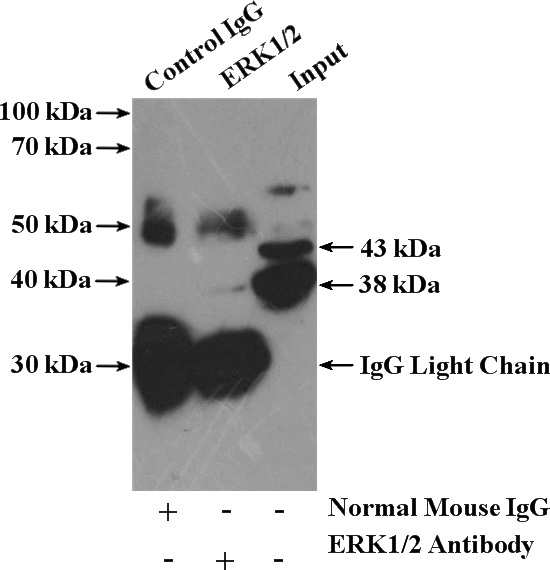 IP Result of anti-ERK1/2 (IP:Catalog No:107194, 5ug; Detection:Catalog No:107194 1:2000) with HeLa cells lysate 2960ug.
