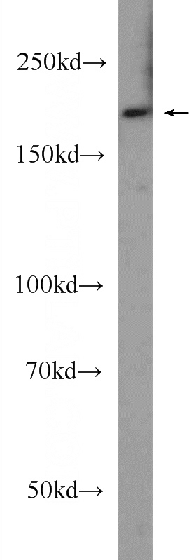 HeLa cells were subjected to SDS PAGE followed by western blot with Catalog No:112323(LRP5 Antibody) at dilution of 1:600