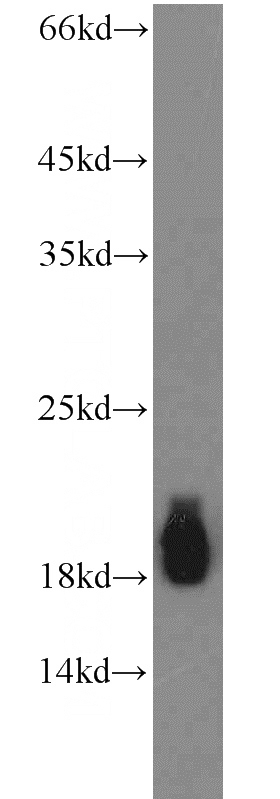 mouse brain tissue were subjected to SDS PAGE followed by western blot with Catalog No:109509(CPLX1 antibody) at dilution of 1:1500