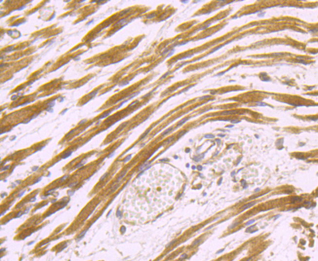 Fig3: Immunohistochemical analysis of paraffin-embedded human fetal skeletal muscle tissue using anti-Dysferlin antibody. Counter stained with hematoxylin.