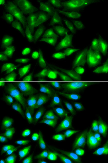 Immunofluorescence - RHOC Polyclonal Antibody 