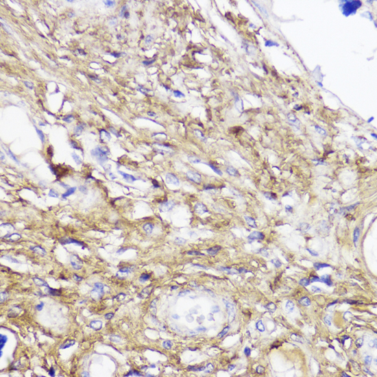 Immunohistochemistry - COL1A1 Polyclonal Antibody 