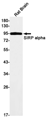 Western blot detection of SIRP alpha in Rat Brain lysates using SIRP alpha Rabbit mAb(1:1000 diluted).Predicted band size:55kDa.Observed band size:85kDa.