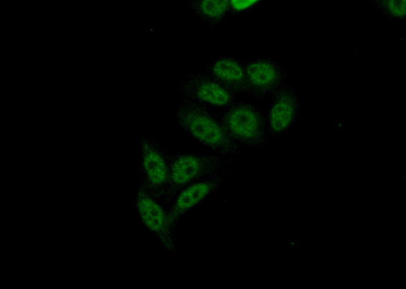Immunofluorescent analysis of (10% Formaldehyde) fixed HepG2 cells using Catalog No:109576(CROP Antibody) at dilution of 1:50 and Alexa Fluor 488-congugated AffiniPure Goat Anti-Rabbit IgG(H+L)