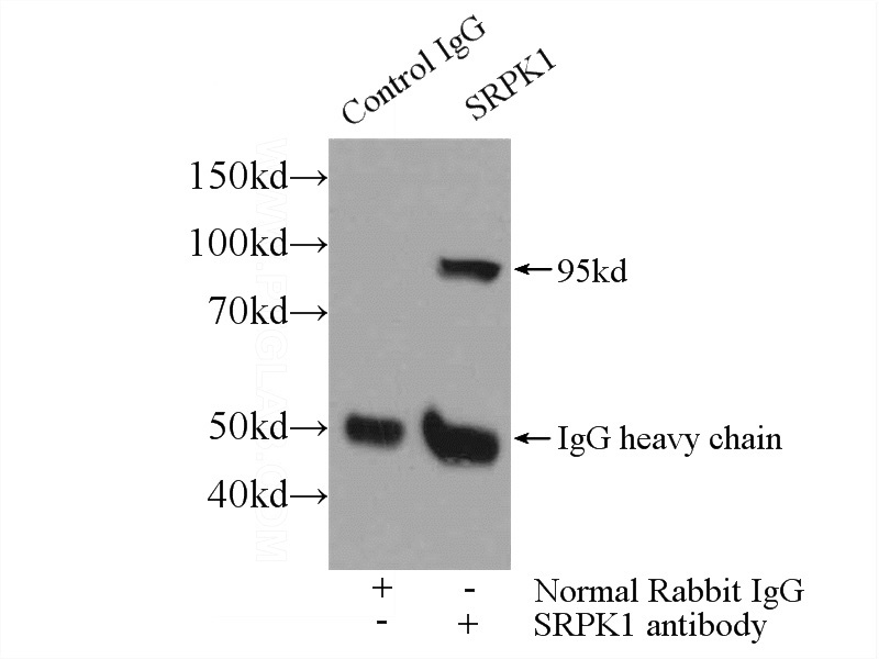 IP Result of anti-SRPK1 (IP:Catalog No:115596, 3ug; Detection:Catalog No:115596 1:1000) with mouse testis tissue lysate 3000ug.