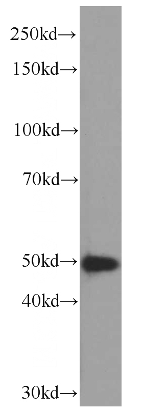 Jurkat cells were subjected to SDS PAGE followed by western blot with Catalog No:107179(CSK antibody) at dilution of 1:1000
