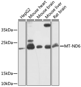Western blot - MT-ND6 Polyclonal Antibody 