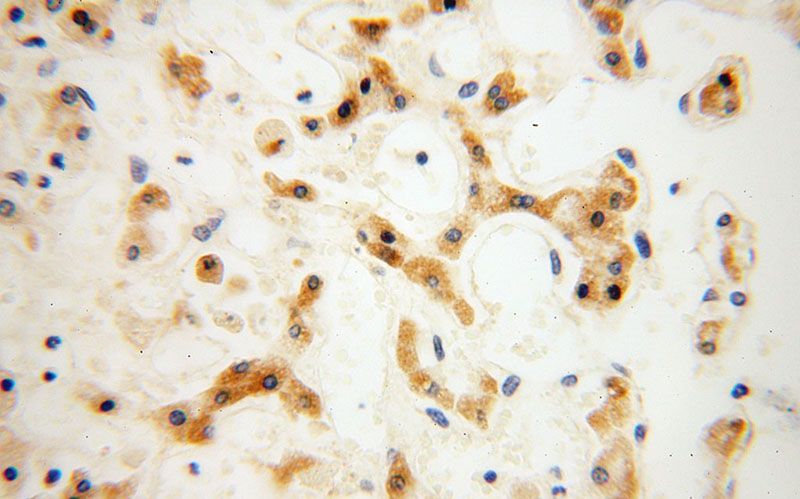 Immunohistochemical of paraffin-embedded human liver using Catalog No:109461(CPOX antibody) at dilution of 1:100 (under 40x lens)
