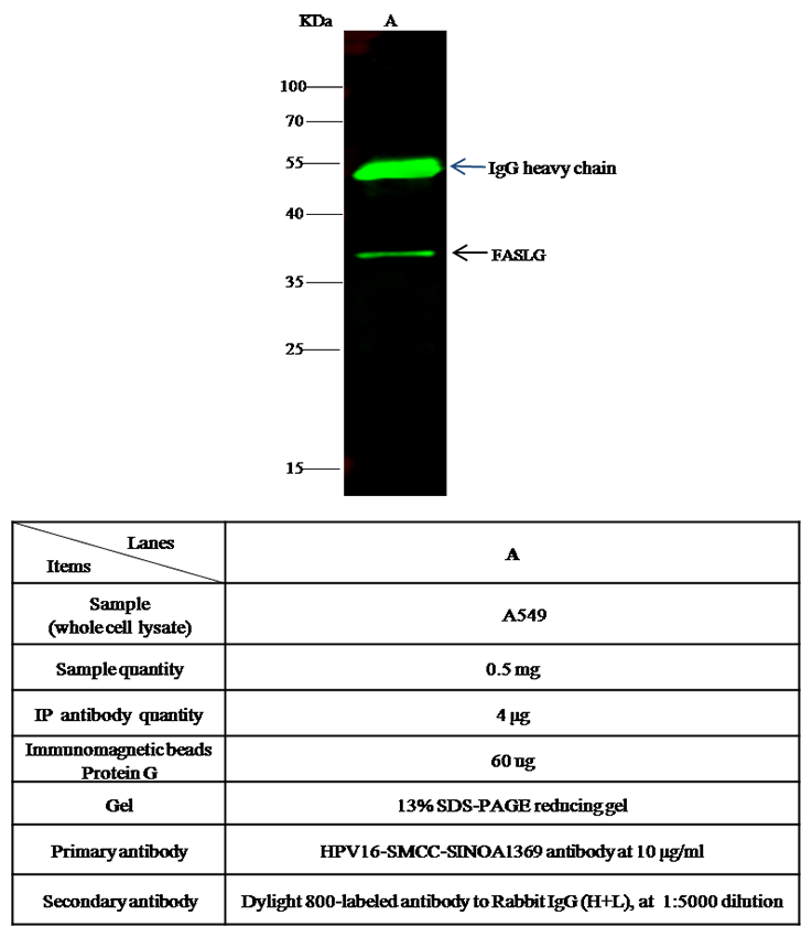 Fas Ligand / FASLG / CD95L Antibody, Rabbit PAb, Antigen Affinity Purified, Immunoprecipitation
