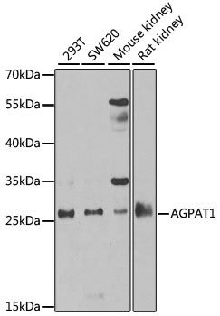 Western blot - AGPAT1 Polyclonal Antibody 