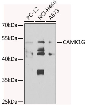 Western blot - CAMK1G Polyclonal Antibody 