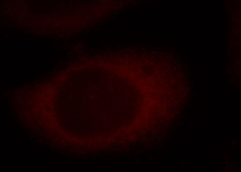 Immunofluorescent analysis of Hela cells, using RAP1GAP antibody Catalog No:114546 at 1:25 dilution and Rhodamine-labeled goat anti-rabbit IgG (red).