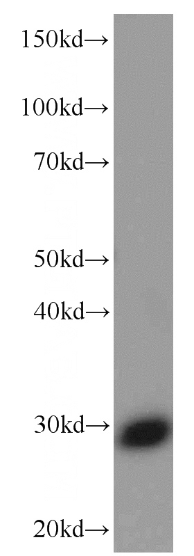 fetal human brain tissue were subjected to SDS PAGE followed by western blot with Catalog No:107059(ANP32B Antibody) at dilution of 1:1000